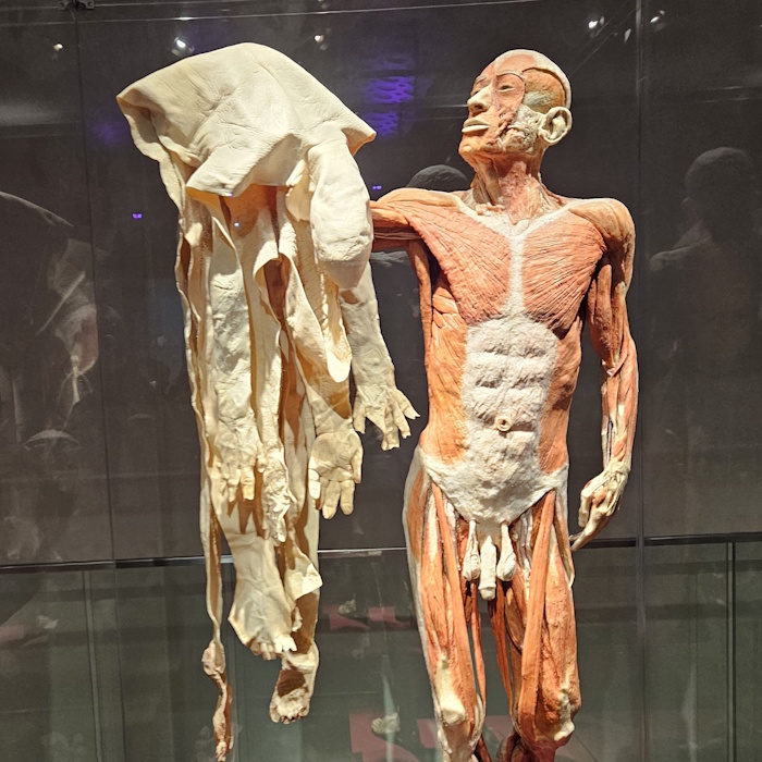 Exponat der Ausstellung Körperwelten